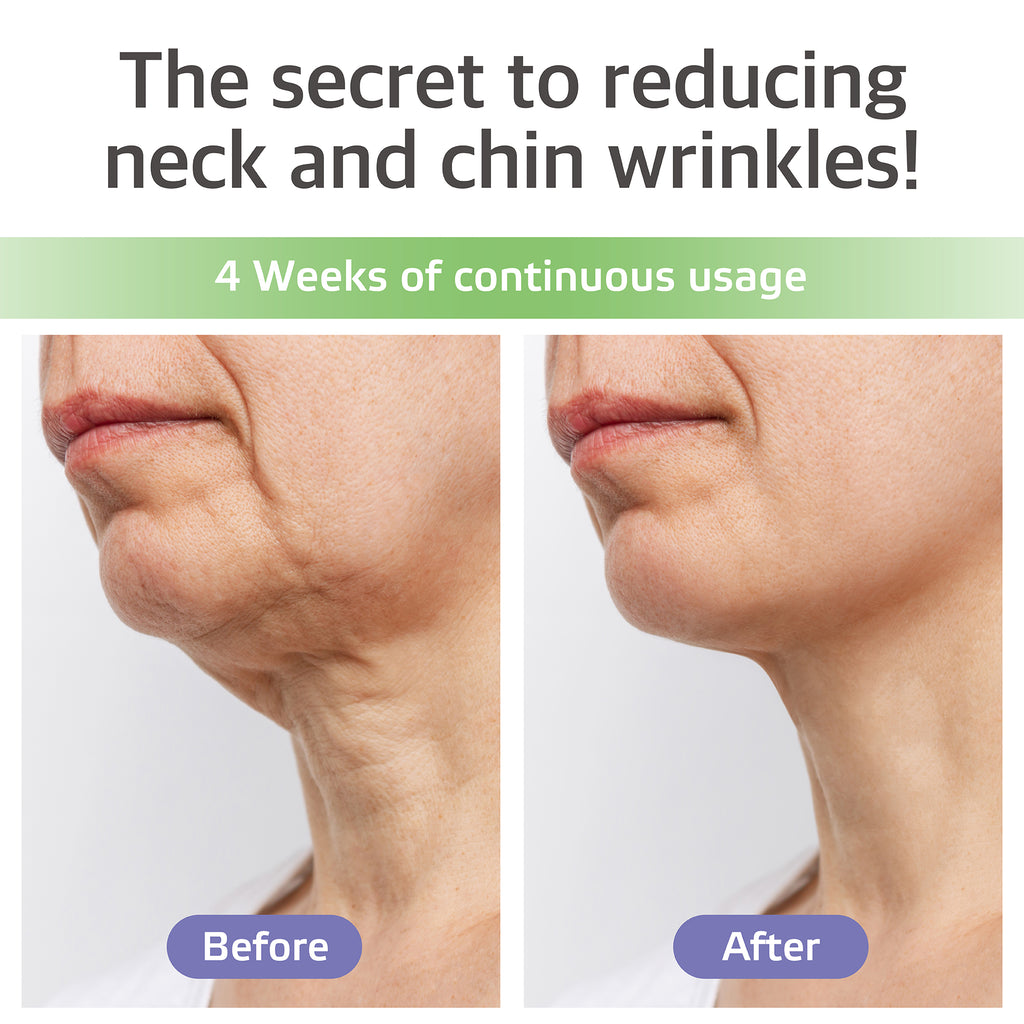 Neck & Chin Care Patch — Parche de Hidrogel para Papada y Cuello