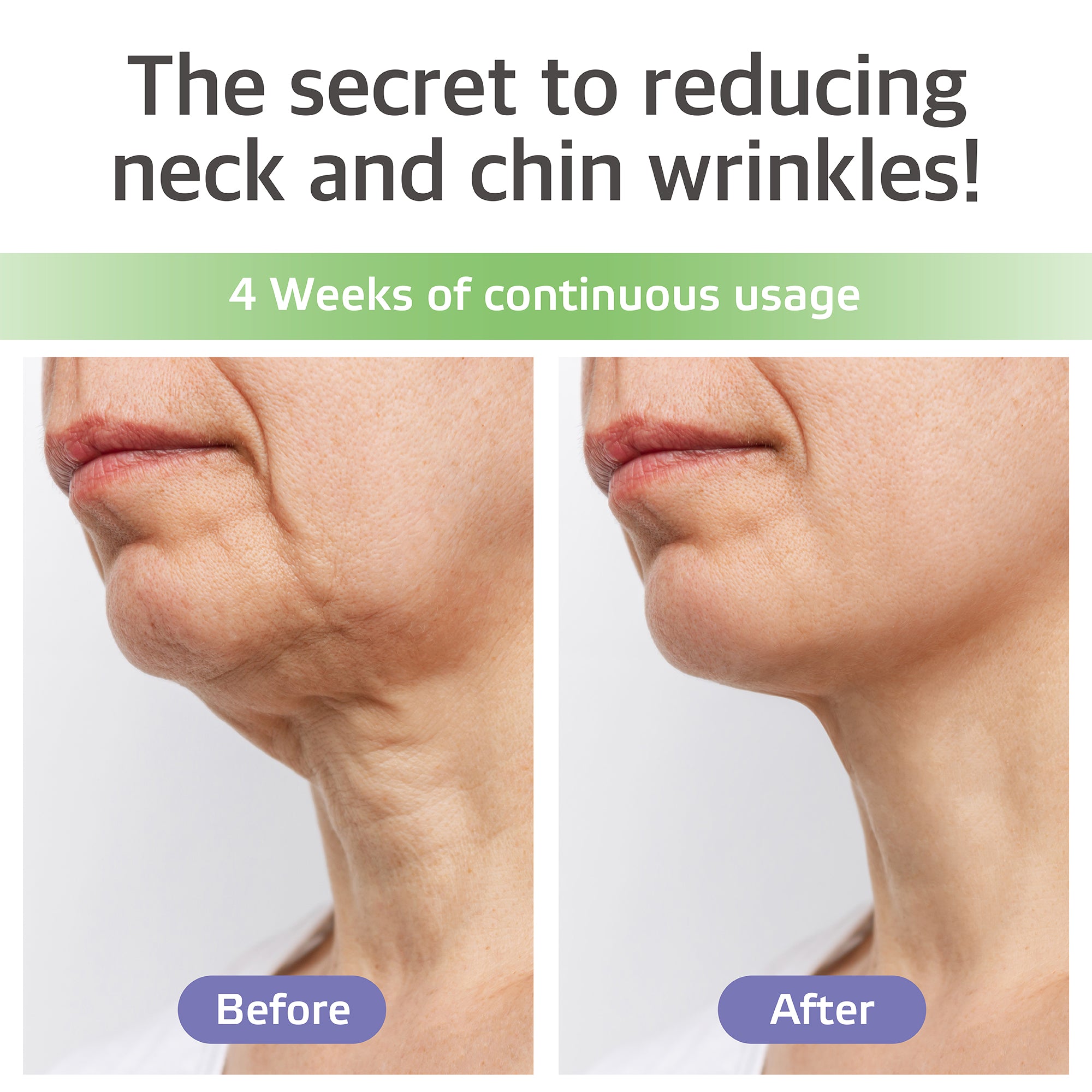 Neck & Chin Care Patch — Parche de Hidrogel para Papada y Cuello